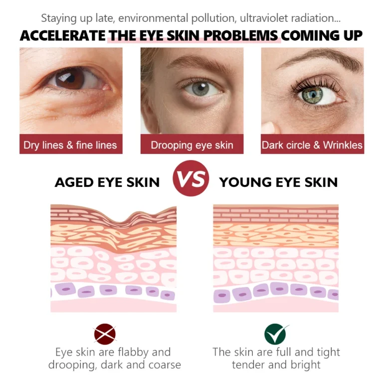 anti wrinkle retinol eye serum dark circle eye bags remover whitening brightening skin moisturizer lightening cream eye care